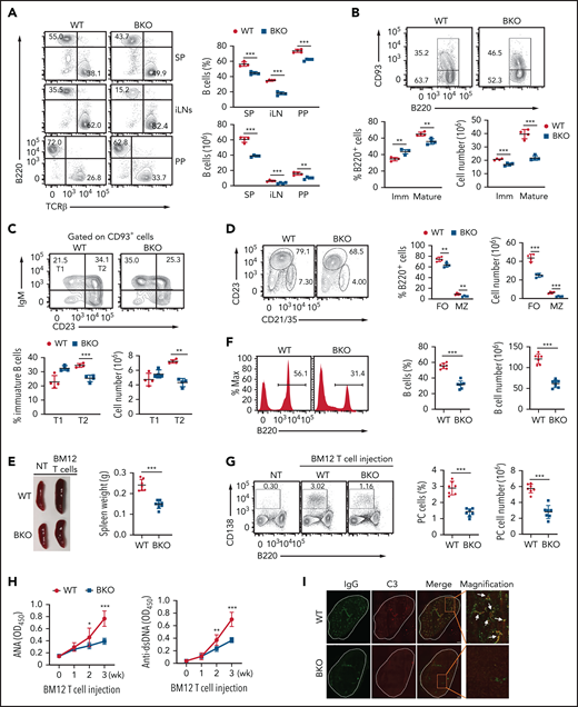 DYRK1a is essential for peripheral B-cell maintenance and B-cell–mediated autoimmunity. (A) Flow cytometric analyses of B220+ B cells and T-cell receptor (TCR) β+ T cells in the spleen (SP), inguinal lymph nodes (iLN), and Peyer’s patches (PP) of WT or Dyrk1aBKO mice (6-8 weeks old). (B-D) Flow cytometric analyses of immature (Imm; B220+CD93+) and mature (B220+CD93−) B cells (B), T1 (CD93+IgM+CD23–) and T2 (CD93+IgM+CD23+) immature B cells (C), and follicular (FO, B220+CD21intCD23+) and marginal zone (MZ; B220+CD21hiCD23−) B cells (D) in the spleen of WT and Dyrk1aBKO mice (6-8 weeks old). (E) A representative spleen image (left) and a summary graph of spleen weight (right, each circle represents a mouse) of WT and Dyrk1aBKO mice that were either not treated (NT) or injected with CD4 T cells from BM12 mice for 3 weeks. (F-G) Flow cytometric analysis of B220+ B cells (F) and B220−CD138+ plasma cells (G) in WT and Dyrk1aBKO mice that were injected with BM12 CD4 T cells for 3 weeks. Data are presented as a representative plot (left) and summary graph (right) based on multiple recipient mice. (H) ELISA of autoantibodies reacting against double-stranded DNA (anti-dsDNA) and nuclear antigen (ANA) in serum from WT and Dyrk1aBKO mice injected with BM12 CD4 T cells for the indicated time periods. (I) Confocal microscopic analyses of glomerular IgG and C3 deposition in kidney sections from WT and Dyrk1aBKO mice injected with BM12 CD4 T cells for 3 weeks. Scale bar, 1 mm. The arrows depict colocalization of IgG and C3. Data are representative of 3 independent experiments. Summary graphs are presented as mean ± SD, and P values were determined by an unpaired, 2-tailed Student t test (A-B,H). *P < .05; **P < .01; ***P < .001.