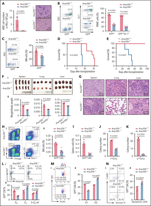 Loss of Anp32b impairs in vivo progression of CML and maintenance of LSCs. (A) Total number of WBCs in PB and Wright-Giemsa staining of PB smears were conducted 15 days after transplant from recipients received BCR-ABL1–transduced Anp32b+/+ and Anp32b−/− Lin− BM cells (n = 5). (B-C) Representative FACS profiles and percentages of GFP+ cells and GFP+Gr-1+ cells in PB (B) and BM (C) 15 days after first transplantation (n = 5). (D) Survival curves for recipients transplanted with BCR-ABL1–transduced Anp32b+/+ and Anp32b−/− Lin− BM cells (n = 6). (E) Survival curves for recipients receiving Anp32b+/+ and Anp32b−/− GFP+ leukemia cells (1 × 106) on secondary transplantation (n = 4). (F-G) Gross pathology (i) and relative weights (ii) (F) and hematoxylin-eosin staining (G) of the spleens, lungs, and livers from recipients received BCR-ABL1–transduced Anp32b+/+ and Anp32b−/− Lin− BM cells at 15 days after transplant (n = 5). (H-I) FACS analysis of GFP+LSK cells in BM (H) or spleen (I) at 15 days after first transplantation. Representative FACS profiles (i) and the percentage of GFP+LSK cells (ii) are shown (n = 5). (J) Colony-forming assays were performed with BM GFP+LSK cells sorted from recipients receiving BCR-ABL1–transduced Anp32b+/+ and Anp32b−/− Lin− BM cells at 12 days after transplant. Colony numbers were calculated at day 6 after plating (n = 3). (K) First plated leukemia cells were further collected and used for second plating at day 6. The numbers of colonies were calculated 7 days after plating (n = 3). (L) Cell cycle analysis of GFP+LSK cells in BM at 15 days after first transplantation Representative FACS profiles (i) and percentages of cell cycle distributions (ii) are shown (n = 4). (M) Cell division tracing of BM GFP+LSK cells. GFP+LSK cells were sorted from recipients received BCR-ABL1–transduced Anp32b+/+ and Anp32b−/− Lin− BM cells at 15 days after transplant and stained with CellTrace Violet dye. After culturing for 24 hours, cell divisions were analyzed by flow cytometry, and the number of generations is shown. Percentages of cells in each generation were calculated (n = 3). G, generation. (N) Apoptosis analysis of GFP+LSK cells in BM 15 days after first transplantation. Representative FACS profiles (i) and the percentage of GFP+LSK cells (ii) are shown (n = 5). Error bars denote mean ± SEM. Statistical significance was determined by a 2-tailed, unpaired Student t test (A-C, F, H-N) or log-rank test (D-E). All animal experiments were repeated at least twice with similar results, and the results of 1 representative experiment are shown.