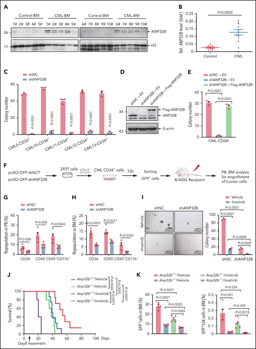 Targeting ANP32B impairs human CML development and synergizes with imatinib therapy to eradicate CML (A-B) Relative ANP32B protein expression levels in bone marrow mononuclear cells (BMMCs) of patients with CML and control patients were analyzed (n = 10). All samples were collected at diagnosis before therapy. All patients with CML were diagnosed in chronic phase and were BCR-ABL1 positive. (C) Colony-forming assay for human CML CD34+ cells infected with shNC or shANP32B. Numbers of colonies were evaluated at day 10 (n = 3). All samples were collected at diagnosis before therapy. All patients with CML were diagnosed in chronic phase and were BCR-ABL1 positive. (D) shNC- or shANP32B-infected human CML CD34+ cells were stably transfected with EV or Flag-tagged ANP32B with the shRNA target sequence mutation, and Western blots of indicated proteins are shown. (E) Colony-forming assay for shNC/EV, shANP32B/EV, and shANP32B/Flag-ANP32B CML CD34+ cells. Colony numbers were counted at day 10 after plating (n = 3). (F) Schematic strategy of evaluation of the in vivo effect of ANP32B knockdown in human CML CD34+ cells. (G-H) Percentages of human CD34+, CD45+, and CD45+CD11b+ cells engrafted in PB (G) and BM (H) 6 months after transplantation (n = 5). Human CD34+ cells sorted from CML patient 10 were used in this experiment. (I) Human CML CD34+ cells (CML patient 10) infected with shNC or shANP32B were seeded into methylcellulose medium with 5μM imatinib or dimethyl sulfoxide as vehicle. Colony numbers were counted at day 10 after plating (n = 3). (J-K) Survival curves for recipients transplanted with BCR-ABL1–transduced Anp32b+/+ and Anp32b−/− Lin− BM cells followed by the treatment with either vehicle or imatinib at day 8 after transplantation (J, n = 5 for Anp32b+/+/vehicle and Anp32b−/−/vehicle group, n = 8 for Anp32b+/+/imatinib, and n = 7 for Anp32b−/−/imatinib group). Percentages of GFP+ cells and GFP+LSK cells in BM were analyzed at day 14 after transplantation (n = 5) (K) Error bars denote mean ± SEM. Statistical significance was determined by a 2-tailed, unpaired Student t test (B-C,E,G-I) or log-rank test (J). The experiments in panels J-K were repeated twice with similar results, and the results of 1 representative experiment are shown. The experiments in panels A-H are presented from an independent experiment.