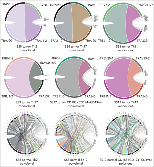 Circos plots confirming monoclonality of FACS Sézary tumor subsets given their monoclonal TRs of the α and β chains. By contrast, corresponding normal CD4+ T-cell subsets isolated from the same patients with SS revealed a typical polyclonal pattern. The extended figure of rearrangement patterns (circos plots), clonality distribution (pie charts), and sample information regarding TRA/TRB rearrangements and CDR3 sequences for all FACS CD4+ T-cell subsets are depicted in supplemental Figures 2 and 3 and supplemental Table 2, respectively.