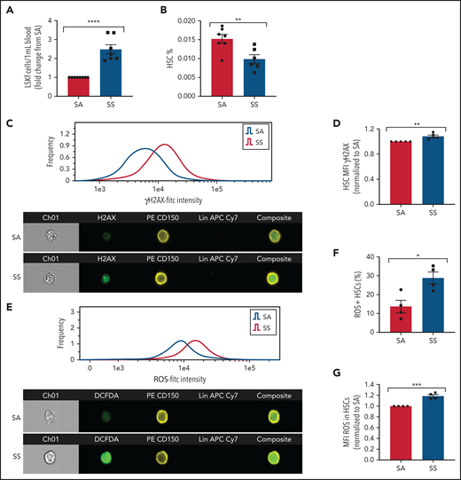 Hematopoietic stem and progenitor cells in SCD. (A) Townes SS mice were analyzed for the peripheral blood hematopoietic stem and progenitor cell population marked by Lin–Sca1+c-Kit+Flt3– represented as fold change in number per mL blood among SS mice relative to SA mice (N = 7-8 mice). (B) Bone marrow HSC frequency was assessed by flow cytometry for Lin–Sca1+c-Kit+CD48–CD150+ (N = 6-7 mice). (C) Representative histogram and images of bone marrow hematopoietic cells from SA and SS mice gated on live cells and stained by Lineage-CD150+γH2AX+ by ImageStream analysis. (D) Quantification by ImageStream of the mean fluorescence intensity (MFI) of γH2AX in sickle mouse HSCs normalized to control HSCs (N = 5 mice). (E) Representative histogram and images of bone marrow hematopoietic cells from SA and SS mice gated on live cells and stained by Lineage-CD150+ and DCFDA by ImageStream analysis. (F) Quantification of the frequency of HSCs containing ROS in sickle and control bone marrow by ImageStream (N = 4 mice). (G) Quantification of the mean fluorescence intensity (MFI) of ROS in sickle and control bone marrow HSCs by ImageStream (N = 4 mice) presented as fold change of SS compared with SA. Data were analyzed with a 2-tailed, unpaired Student t test. Data are presented as mean ± standard error of the mean. *P ≤ .05, **P ≤ .01, ***P ≤ .001, ****P ≤ .0001.