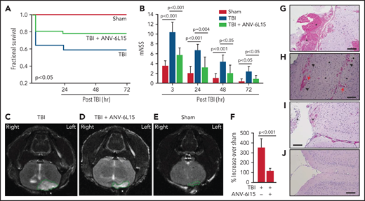 ANV-6L15 increased survival, improved neurological function, and reduced hematoma in TBI mice. C57BL/6 male mice were subjected to FPI and received 90 µg/kg of ANV-6L15 by IV 30 minutes postinjury or underwent sham surgery. (A-B) Their 3-day survival was measured by Kaplan Meier survival analysis (A) (n = 12 mice per group), and their neurological functions were evaluated using mNSS (B) (n = 12 mice per group, 1-way ANOVA). (C-D) TBI and sham mice also received MRI scans 3 hours after injury. FPI induced large subdural hematoma (the white area enclosed by the green circle; asterisk indicates the site of FPI) and intraventricular hemorrhage (C), which was significantly reduced in TBI mice receiving ANV-6L15 (D). (E-F) Small cerebral lesions were also detected in sham mice (E), and their volume was set as the baseline on which the hematoma volume of TBI mice was calculated (F) (n = 6 mice per group, paired Student t test). (G-H) Representative images of H&E stained cerebral tissue from TBI mice show a large subdural hematoma (asterisk; scale bar, 50 µm) (G), substantial intracerebral (black arrows) and perivascular hemorrhage (red arrows) (H), and multiple foci of cerebral edema (black star; scale bar, 50 µm). (I-J) These changes were less severe in TBI mice receiving ANV-6L15 (I) (asterisk denotes subdural hematoma, scale bar, 50 µm), and were not observed in sham mice (J).