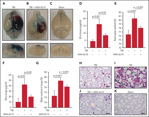 ANV-6L15 reduced TBI-induced vascular permeability. (A-C) Topical and coronal views of representative mouse brains collected 6 hours after TBI show hematoma (dark red) and vascular permeability (blue), both of which were reduced in TBI mice receiving ANV-6L15 and not observed in sham mice. (D) Summary of Evans blue tests from multiple experiments (n = 8 mice per group, 1-way ANOVA on ranks). (E) Brain-water content of TBI mice receiving either ANV-6L15 or control, and of sham mice (n = 8 mice per group, 1-way ANOVA). Lungs from these mice were examined for vascular leakage (F) and tissue edema (G) (n = 8 mice per group, one-way ANOVA). Representative H&E stains of lung sections show red cell accumulation in the alveolar spaces of TBI mice (H) (arrow: RBCs, scale bar, 50) and capillary dilation (I) (asterisk: RBC in alveolar space, green arrows: dilated capillaries; scale bar, 200 µm). The acute lung injury was drastically reduced in TBI mice receiving ANV-6L15 (J) (arrowhead: microbleed, arrow: interstitial edema; scale bar, 50 µm) and was not observed in sham mice (K) (scale bar, 50 µm).