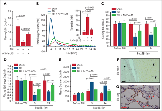ANV-6L15 blocked the TBI-induced hypercoagulable state. (A) TBI significantly shortened tail bleeding, measured 1 hour post-FPI, and this was partially reversed by ANV-6L15 (n = 7 mice per group, 1-way ANOVA). (B-E) The TBI-induced hypercoagulation and its blockage by ANV-6L15, as measured by thrombin generation (B) (graph: thrombin generation plots, bar-graph insert: peak-thrombin generation, n = 9 mice per group), clotting time (C), plasma fibrinogen (D), and D-dimer (E). The data in panels C-E was analyzed using 1-way ANOVA (n = 9 mice per group). (F-G) Representative images of intravascular fibrin deposition detected using PTAH stains in cerebral (F) (arrowhead: microvascular bleeding, arrow: fibrin; scale bar, 20 µm) and pulmonary interstitial microvessels (G) (red arrow: fibrin deposition; scale bar, 50 µm) of TBI mice (×20 objective).