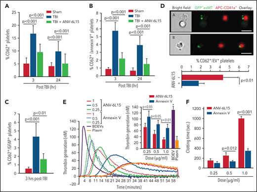 The severity of thrombocytopenia and the level of activated platelets were reduced in the TBI mice receiving ANV-6L15. Circulating platelets that expressed CD62p (A) and those that expressed both CD62p and PS (B) (n = 9 mice per group, 1-way ANOVA). (C) Platelets formed a complex with BDEVs and its blockage by ANV-6L15 (n = 9 mice per group, one-way ANOVA). (D) Platelets formed a complex with exMT in the absence and presence of 1 µg/ml of ANV-6L15, as detected by image flow cytometry. Top panel: representative images of GFP-exMT-platelet complexes (scale bar, 5 µm). Bottom panel: summary of 12 independent experiments (Student t test). (E) Thrombin generation induced by 3.5 × 103/µL of BDEVs in the presence of increasing concentrations of either ANV-6L15 or ANV. Graph: representative images. Insert: summary of 26 independent experiments (1-way ANOVA). (F) Clotting time induced by 6 × 103/µL of BDEVs in the presence of either ANV-6L15 or ANV (n = 13 mice per group, 1-way ANOVA). To be consistent with other experiments, ANV-6L15 was compared with ANV by weight (µg/mL), not by molar concentrations. Because of a smaller molecular mass, the results suggest that ANV was even less efficacious than ANV-6L15 in blocking thrombin generation.