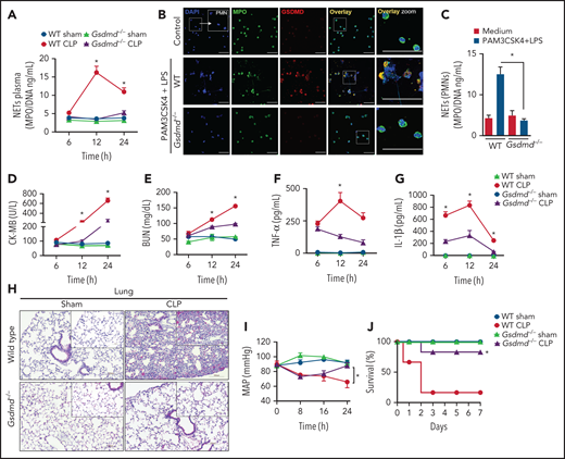 Gasdermin D contributes to organ dysfunction in sepsis by NET release. (A) The MPO/DNA-NET concentrations in the plasma from WT and Gsdmd−/− mice were determined at 6, 12, or 24 hours after sepsis induction by CLP. (B) Bone marrow neutrophils from WT and Gsdmd−/− mice were primed with PAM3CSK4 (1 µg/mL) for 4 hours and then transfected with ultrapure LPS (10 µg/mL) for 4 hours. Representative fluorescence images of NETs stained for DNA (DAPI, blue), myeloperoxidase (MPO, green), and the gasdermin D cleaved fraction (GSDMD, red) are shown. Scale bar, 50 µm at ×630 magnification. (C) The concentrations of MPO/DNA-NETs in the neutrophil culture supernatants after 4 hours of stimulation were determined using the picogreen test. (D-E) The plasma levels of the organ injury markers CK-MB and BUN and (F-G) TNF-α and IL-1β were determined at 6, 12, and 24 hours after sepsis induction by CLP. (H) Representative histopathology images of lung tissue sections 24 hours after sepsis induction by CLP are shown at ×200 magnification. The square insets represent the image at ×400 magnification. (I) Blood pressure was continuously monitored by telemetry, which was used to calculate the MAP for 24 hours after sepsis induction by CLP. (J) WT and Gsdmd−/− mice were subjected or not to CLP, and survival was recorded for 7 days. The data are expressed as means ± SEM. *P < .05; WT CLP vs Gsdmd−/− CLP, Student t test (A,D-I), 1-way ANOVA followed by Tukey's test (C); H-Mantel-Cox log-rank test (J). The data are representative of ≥2 independent experiments, each including 5-7 animals per group.