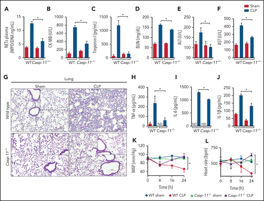 Caspase-11 deletion prevents NET release and organ dysfunction during polymicrobial sepsis. (A) Circulating amounts of MPO/DNA-NETs were quantified 24 hours after sepsis induction by CLP. (B-F) Plasma levels of organ injury markers. (G) Representative images of H&E staining of lung tissue sections from WT and Casp11−/− mice 24 hours after sepsis induction by CLP are shown at ×200 magnification. The square insets represent the image at ×400 magnification. (H-J) The plasma levels of the cytokines TNF-α, IL-6, and IL-1β (G-I) were determined 24 hours after sepsis induction by CLP. (K-L) WT and Casp11−/− mice were implanted using a telemetric pressure transmitter probe to determine the MAP and HR 24 hours after CLP-induced sepsis. The data are expressed as means ± SEM. *P < .05; 1-way ANOVA followed by Tukey’s test (A-F,H-J), CLP WT vs CLP Casp11−/− Student t test (K,L). The data are representative of ≥ 2 independent experiments, each including 4 to 7 animals per group.