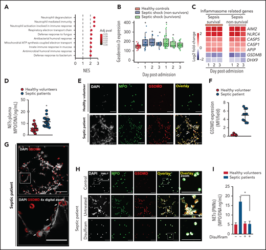 Neutrophils from septic patients who undergo NETosis express gasdermin D. (A) Gene set enrichment analysis identified “neutrophil degranulation,” “neutrophil-mediated immunity,” and “neutrophil activation involved in immune response gene sets” as the top 3 GO terms with the highest normalized enrichment score in nonsurvivor patients with septic shock at day 1 after ICU admission compared with healthy volunteers (adjusted P < .1). (B) Expression levels of Gsdmd in healthy volunteers and patients with septic shock (adjusted P < .1). (C) Heatmap representation of differentially expressed genes in surviving and nonsurviving patients with septic shock compared with healthy volunteers at days 1, 2, and 3 after ICU admission (adjusted P < .1). (D) Circulating amounts of MPO/DNA-NETs were quantified from the plasma of patients with sepsis and healthy volunteers. (E) Neutrophils from patients with sepsis and healthy volunteers were isolated and cultured for 4 hours at 37°C. Representative immunostaining images for DNA (DAPI, gray), myeloperoxidase (MPO, green), and the gasdermin D cleaved fraction (GSDMD, red) are shown. Scale bar, 50 µm at ×630 magnification. (F) GSDMD expression was quantified by Median Fluorescence Intensity (MFI) per field. (G) Magnified fluorescence microscopy images of panel E for DNA (DAPI, gray) and the gasdermin D cleaved fraction (GSDMD, red) are shown. Scale bar, 50 µm at ×630 magnification. Furthermore, to demonstrate the details of GSDMD in neutrophil membranes and its association with NETs (G, top), we performed a 4× digital zoom of the inset square (G, bottom). (H) Neutrophils from patients with sepsis and healthy volunteers were isolated, treated with disulfiram (30 µM) or vehicle, and cultured for 4 hours at 37°C. Representative fluorescence images of NETs stained for DNA (DAPI, gray), myeloperoxidase (MPO, green), and the gasdermin D cleaved fraction (GSDMD, red) are shown. Scale bar, 50 µm at ×630 magnification. (I) The concentrations of MPO/DNA-NETs in the neutrophil culture supernatant after 4 hours were determined using the picogreen test. The data are expressed as means ± SEM. *P < .05; Student t test (D), 1-way ANOVA, followed by Tukey’s test (I). The data are representative of ≥2 independent experiments.