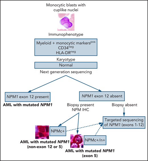 When to suspect AML with mutated NPM1, including rare types.