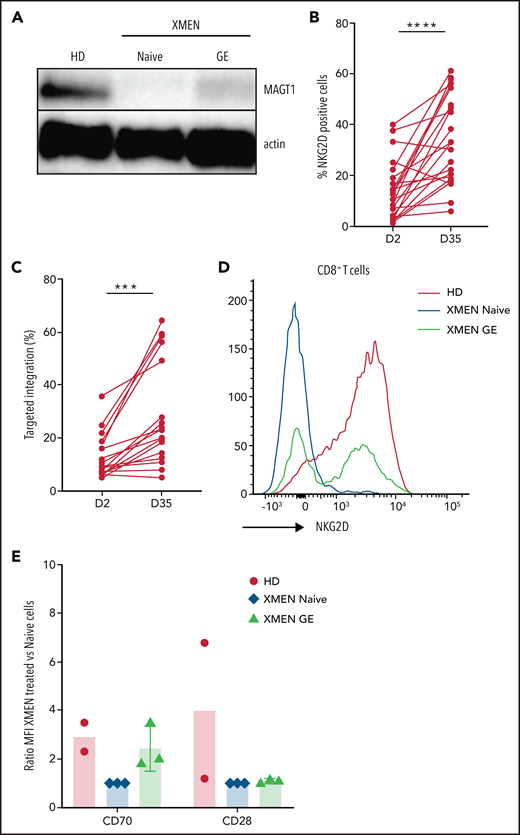 GE in XMEN T cells. (A) Representative western blot for MAGT1 protein expression in HD XMEN (naive and gene edited) T cells with β-actin as loading control. (B) Percentage of NKG2D-positive CD8+ T cells in AAV-treated T cells at days 2 and 35 post-EP (data are representative of 8 independent experiments; XMEN patients P1 and P2). (C) Targeted insertion rates measured at day 2 and day 35 post-EP (data are representative of 8 independent experiments). (D) Representative flow cytometry histogram overlaying NKG2D expression in HD and XMEN (naive and gene-edited) T cells at day 35 after GE. Percentage of NKG2D+ in gene-edited CD8+ XMEN T cells was 57.5% and TI was 64.6%. (E) Expression of CD70 and CD28 by flow cytometry for HD and XMEN (naive and gene-edited) T cells at day 28 post-EP; data are expressed as the ratio of MFI normalized to XMEN untreated cells for CD70 and CD28 (data are representative of 2-3 independent experiments). A paired sample Student t test was used. ***P < .001; ****P < .0001.