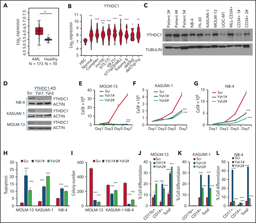 YTHDC1 regulates proliferation and survival of human AML cells in an m6A-dependent manner. (A) Comparison of the expression level of YTHDC1 in patients with primary AML vs healthy donors from The Cancer Genome Atlas database. (B) Comparison of the expression level of YTHDC1 in patients with primary AML bearing various chromosomal translocations vs those in BM HSCs collected from healthy donors. The expression values (detected by using Affymetrix exon arrays) were log2-transformed. The P value was detected by 1-way analysis of variance followed by multiple comparisons vs the HSC group. Normal: AML with normal karyotype; Complex: AML with complex karyotype. (C) Western blot showing protein level of YTHDC1 in AML patient cells, AML cell lines, and CD34+ cells from healthy donor. (D) Western blot indicating KD efficiency of YTHDC1 by specific shRNAs in NB-4, KASUMI-1, and MOLM-13 cells. Growth curve of MOLM-13 (E), KASUMI-1 (F), and NB-4 (G) cells expressed Scramble shRNA (Scr), YTHDC1 shRNA1# (Ysh1#), and YTHDC1 shRNA2# (Ysh2#); cells were counted every 2 days. (H) Flow cytometric analysis of apoptosis frequency of MOLM-13, KASUMI-1, and NB-4 cells expressed Scramble shRNA (Scr), YTHDC1 shRNA1# (Ysh1#), and YTHDC1 shRNA2# (Ysh2#). Annexin V+ indicated the apoptotic cells. (I) Colony-forming units of MOLM-13, KASUMI-1, and NB-4 cells expressed Scramble shRNA (Scr), YTHDC1 shRNA1# (Ysh1#), and YTHDC1 shRNA2# (Ysh2#). Colony number was counted 7 days after plating; 2000 cells per well for MOLM-13 and KASUMI-1 input; 1000 cells per well for NB-4 input. Flow cytometric analysis of differentiated cell frequency (CD11b+only, CD14+ only, and total) of MOLM-13 (J), KASUMI-1 (K), and NB-4 (L) cells expressed Scramble shRNA (Scr), YTHDC1 shRNA1# (Ysh1#), and YTHDC1 shRNA2# (Ysh2#). Data are presented as mean ± standard deviation; Student t test. *P < .05; **P < .01; ***P < .001.