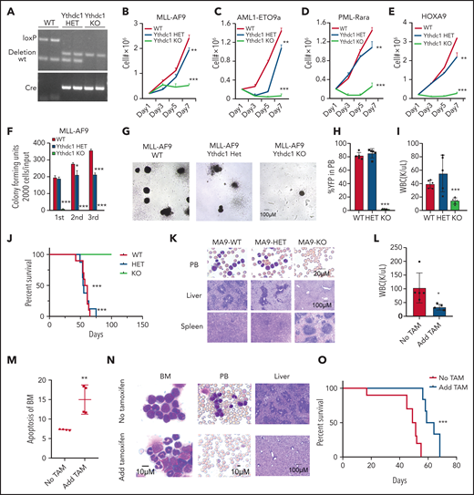 Ythdc1 is required for AML development and maintenance in vivo. (A) Semi-quantitative PCR analysis of Cre and the deletion of Ythdc1, loxP-flanked Ythdc1 allele (loxP), and wild-type (wt) among genomic DNA in BM Lin– cells from Ythdc1fl/+ (WT), Ythdc1fl/+Mx1-Cre (Ythdc1 HET), and Ythdc1fl/flMx1-Cre (Ythdc1 KO) mice; deletion was induced by pIpC injection. Growth curve of Lin– BM cells from WT, Ythdc1 HET, and Ythdc1 KO mice expressed MLL-AF9 (B), AML1-ETO9a (C), PML-Rara (D), and HOXA9 (E). Colony-forming units of Lin– BM cells from WT, Ythdc1 HET, and Ythdc1 KO mice expressed MLL-AF9 (F); representative images of the colonies for the third round (WT and HET) or first round (KO) of plating are displayed (G). Cells were resuspended and replated weekly in MethoCult medium (STEMCELL Technologies) containing cytokines; scale bar, 100 μM. (H) Flow cytometric analysis of engraftment of yellow fluorescent protein (YFP)-positive cells in PB from MLL-AF9-WT (WT), MLL-AF9-Ythdc1 HET (HET), and MLL-AF9-Ythdc1 KO (KO) mice 1 month post-transplantation; n = 5 mice for each group. (I) Complete blood count analysis of WBCs in MLL-AF9-WT (WT), MLL-AF9-Ythdc1 HET (HET), and MLL-AF9-Ythdc1 KO (KO) mice 1 month post-transplantation; n = 5 mice for each group. (J) Kaplan-Meier survival analysis of MLL-AF9-WT (WT), MLL-AF9-Ythdc1 HET (HET), and MLL-AF9-Ythdc1 KO (KO) mice; n = 10 mice for the WT group, n = 8 mice for the HET group, n = 5 mice for the KO group. (K) Wright-Giemsa–stained PB and hematoxylin and eosin–stained spleen and liver of the MLL-AF9-WT (WT), MLL-AF9-Ythdc1 HET (HET), and MLL-AF9-Ythdc1 KO (KO) mice are shown. Scale bars, 20 μM for PB, 100 μM for spleen and liver. (L) Complete blood count analysis of WBCs in MLL-AF9-Ythdc1fl/fl ER Cre mice with or without TAM treatment. Mice were injected with 2 mg of TAM in 100 μL corn oil once a day for 5 consecutive days by intraperitoneal injection when the leukemia cell ratio reached up to 10% in PB; n = 5 mice for each group. (M) Flow cytometric analysis of apoptosis frequency of BM cells isolated from MLL-AF9-Ythdc1fl/fl ER Cre mice with or without TAM treatment 1 month postadministration; n = 4 mice for each group. (N) Wright-Giemsa–stained BM and PB and hematoxylin and eosin–stained liver of the MLL-AF9-Ythdc1fl/fl ER Cre mice with or without TAM treatment 1 month postadministration; Scale bars, 10 μM for BM and PB cells, 100 μM for liver sections. (O) Kaplan-Meier survival analysis of MLL-AF9-Ythdc1fl/fl ER Cre mice with or without TAM treatment; n = 10 mice for the non-treatment group, n = 6 mice for the TAM treatment group. Data are presented as mean ± standard deviation; Student t test or log-rank (Mantel-Cox) test for survival curve. *P < .05; **P < .01; ***P < .001.