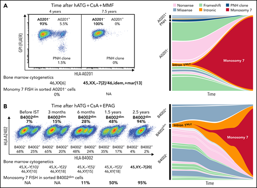 Clonal evolution of monosomy 7 from HLA class I allele-lacking clones. (A) A 56-year-old female at the time of severe AA diagnosis, who received hATG, CsA, and mycophenolate mofetil (MMF), and multiple rounds of salvage IST, including rabbit ATG, daclizumab and danazol, and alemtuzumab, without adequate response, had clonal evolution to monosomy 7 approximately 7.5 years after her initial diagnosis of AA and died 6 months later. Her blood, sampled 4 years after the institution of initial IST, contained a PNH clone and HLA-A0201-lacking cells (A0201-), consistent with the diagnosis of immune AA. Multiple clones with HLA-A*02:01 deactivating mutations constituted sorted A0201- cells (multiple clones with missense mutations also did A0201+ cells), from which chromosome 7 deletion was not detected by fluorescent in situ hybridization (FISH). After 3.5 years, virtually all hematopoiesis was replaced by a preexisting A0201- clone with an intron 1 mutation (intron 1mut; c.74-19A>G) that had acquired monosomy 7. (B) A 72-year-old man at the time of severe AA diagnosis was treated with hATG, CsA, and EPAG with a partial response at 6 months but had declining cytopenia which responded to reinitiation of CsA. About 2.5 years from the initial diagnosis and IST treatment, BM cytogenetics revealed monosomy 7, and myelodysplastic syndrome was diagnosed. The patient received symptomatic treatment (infrequent blood transfusions twice a year) and died of pneumonia 3.5 years later. HLA flow cytometry of cryopreserved cells revealed a gradual expansion of a clone partially lacking HLA-B4002 (B4002dim), which was attributed to an HLA-B*40:02 intron 1 mutation (c.74-9C>A). A small monosomy 7 clone that was not visible by conventional BM cytogenetics by Giemsa-banding was detected by FISH from the sorted B4002dim cells at least 2 years before clinical diagnosis of monosomy 7. NA, not assessed (due to deficient cryopreserved cells for analysis). See also supplemental Tables 8 and 9.