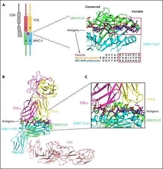 Structural insight into DRB1-antigen-TCR interactions. (A) Peptides of vimentin (UniProt: P08670, VIME_HUMAN, 59-71), EBV DNA polymerase (UniProt: P03198, DPOL_EBVB9, 628-641), MBP (UniProt: P02686, MBP_HUMAN, 217-231) at the HLA binding site based on the alignment of crystal structures of DRB1*15:01-DRA*01:01/MBP (217-231) (PDB: 1BX2), DRB1*14:02-DRA*01:01/vimentin (amino acid positions: 59-71, PDB:1H15), and DRB5*01:01-DRA*01:01/EBV DNA polymerase (628-641) (PDB:6ATF). The red squares indicate the peptide portions presenting with more conformational variability (in interaction with the right site of the HLA binding groove). This 3D structure has been prepared with PyMOL using the crystal structure of DRB1*15:01-DRA*01:01/MBP (PDB: 1BX2). (B) Modeled ternary structure of HLA-Antigen-TCR-CD4. (C) Detail of the interaction interface in HLA-antigen-TCR. The 3 antigenic structures are aligned as shown above. The risk amino acid pattern within the right side of the binding groove interacts with a more variable antigenic portion that contacts directly with the TCR β chain (software PyMOL). EBV, Epstein-Barr virus; MHC, major histocompatibility complex.
