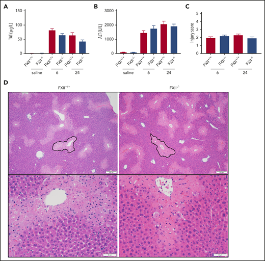FXII deficiency does not protect against APAP toxicity. (A) Plasma concentration of TAT complexes at 6 and 24 hours post-APAP administration. (B) Plasma ALT activity, an assessment of hepatotoxicity. (C) Histologic scoring of liver pathology according to supplemental Table 1. (D) Representative photomicrographs of liver histology from FXII+/+ and FXII−/− mice at 24 hours after APAP treatment, ×40 and ×100 original magnification. A representative pericentral necrotic lesion is outlined in black. N = 18 to 19 mice per group, combined from 3 independent experiments. Saline samples collected at 24-hour time point (N = 6 mice per group). Error bars represent standard error of the mean.