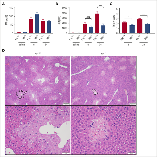 HK deficiency does not inhibit coagulation activation, but does ameliorate APAP-induced hepatotoxicity. (A) Plasma concentration of TAT complexes at 6 and 24 hours post-APAP administration. (B) Plasma ALT activity. (C) Histologic scoring of liver pathology according to supplemental Table 1. (D) Representative photomicrographs of liver histology from HK+/+ and HK−/− animals at 24 hours after APAP treatment, ×40 and ×100 original magnification. A representative pericentral necrotic lesion is outlined in black. N = 26 to 30 mice per group, combined from 6 independent experiments. Saline samples collected at 24-hour time point. N = 9 to 10 mice per group. Error bars represent standard error of the mean. *P < .05, **P < .01, ***P < .001.