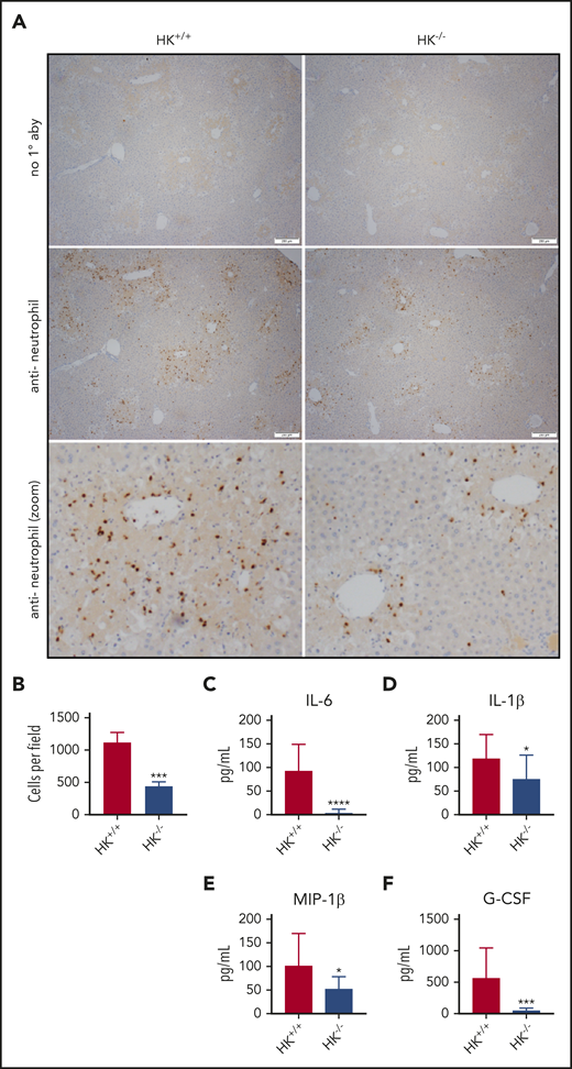 Neutrophil recruitment and inflammation are blunted in HK-deficient mice. (A) Representative photomicrographs from HK+/+ and HK−/− APAP-treated mice, ×40 original magnification, and digitally zoomed. Positive chromogenic peroxidase staining represents neutrophil infiltration in the necrotic areas of the liver, and no primary antibody (1° aby) is used as an assay control. (B) Quantification of neutrophils per field, average counts of positively stained neutrophils per three 40× fields per mouse. N = 18-19 mice per group, combined from 3 independent experiments. Error bars represent standard error of the mean. (C-F) Plasma concentration of cytokines as indicated; N = 12 to 13 mice per group. All data collected at 24 hours after APAP administration. *P < .05, ***P < .001, ****P < .001 vs HK+/+. G-CSF, granulocyte colony-stimulating factor; MIP-1β, macrophage inflammatory protein-1β.