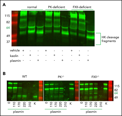 Plasmin cleaves HK independent of contact system activation in plasma. (A) Western blot of human plasma HK in a normal, PK-deficient, and FXII-deficient patient. Green = polyclonal antibody against the light chain of hHK. Cleavage products of HK (∼52 kDa) are shown after the addition of vehicle (saline +0.2% glycerol), kaolin (200 µg/mL), or plasmin (116 µg/mL) for 1 hour at 37°C. (B) Western blot of plasma HK in WT, PK−/−, and FXII−/− mice. Green = polyclonal antibody against the FXI- and PK-binding domain within the light chain of HK. Mouse plasma was treated with either plasmin (μg/mL) at indicated concentrations or kaolin 200 µg/mL (K) for 1 hour at 37°C.