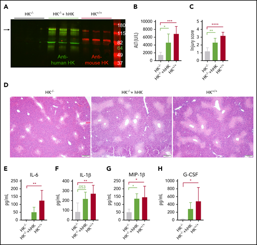 HK reconstitution exacerbates liver injury. (A) Western blot of plasma HK in deficient (HK−/−), reconstituted (HK−/− + hHK), and sufficient (HK+/+) mice. Green = polyclonal antibody against the light chain of hHK. Red = polyclonal antibody against the FXI- and PK-binding domain within the light chain of mouse HK. Arrow indicates full-length HK (∼120 kDa). (B) Circulating levels of ALT in plasma from HK-deficient animals, HK-deficient animals reconstituted with hHK, and HK-sufficient animals. (C) Injury score calculated based on criteria in supplemental Table 1, three 100× fields per mouse. (D) Representative photomicrographs indicating necrotic area in HK−/−, HK−/− + hHK, and HK−/− mice. (E-H) Quantitation of plasma concentration of cytokines as indicated. N = 6 mice per group. All data collected at 24 hours after APAP administration. Error bars represent standard deviation of the mean. *P < .05, **P < .01, ***P < .001, ****P < .0001. G-CSF, granulocyte colony-stimulating factor; MIP-1β, macrophage inflammatory protein-1β.