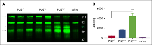 Plasminogen presence correlates with HK cleavage in situ. (A) Western blot of mouse liver homogenate after APAP exposure. Green = polyclonal antibody against the FXI- and PK-binding domain within the light chain of mouse HK. PLG knockout (−/−), heterozygous (+/−), and WT (+/+), and vehicle (saline) animals as indicated. Green arrow indicates full-length HK (∼120 kDa). Solid black arrow indicates plasmin-cleaved HK (∼60 kDa). Dashed black arrow indicates a cleavage product that increases with plasmin presence (∼52 kDa). (D) Plasma levels of ALT in PLG−/−, PLG+/−, PLG+/+, or saline vehicle mice 24 hours after APAP exposure. N = 6 mice per group. ***P < .001.