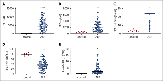 Activation of fibrinolysis and cleavage of HK in plasma from human patients with ALF. (A) Plasma ALT activity in normal individuals (control) and patients with ALF. (B) Circulating concentration of PAP complexes. (C) tPA-mediated clot lysis time. Longer times indicate reduced fibrinolytic capacity. (D) Plasma concentration of intact HK. (E) Plasma concentration of cleaved HK. N = 8 normal controls, 67 with ALF. Bars represent the sample mean. *P < .05, **P < .01, ****P < .0001.