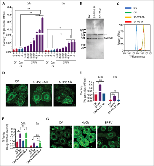 SARS-CoV-2–SP-PV infection increases cell surface TF activity and releases TF+ vesicles in human MDMs. (A) MDMs were treated with control vehicle (CV) or infected with SARS-CoV-2–SP-PV (SP-PV) or vesicular stomatitis virus G protein envelope pseudotyped lentivirus, which was generated and isolated in the same fashion as of SARS-CoV-2–SP-PV, as a control pseudovirus (Con-PV). At the indicated time, the cell supernatants were removed, and the EVs released into the conditioned medium were isolated by centrifugation at 21 000g for 1 hour. TF activity associated with the cell surface or EVs was determined by adding FVIIa (10 nM) and the substrate factor X (175 nM) and measuring the rate of factor Xa generation in a chromogenic assay. (B-D) Analysis of total and cell surface TF protein expression in MDMs treated with CV or infected with SARS-CoV-2–SP-PV by immunoblot analysis (B), flow cytometry (C), or immunofluorescence confocal microscopy (D). (E-F) Intact MDMs infected with SARS-CoV-2–SP-PV (for 6 hours) or EVs released from the infected MDMs were incubated with polyclonal rabbit anti-human TF antibody (10 µg/mL) for 1 hour (E) or annexin V (400 nM) for 30 minutes (F) before measuring cell surface– or EV-associated TF activity as described in panel A. (G) SARS-CoV-2–SP-PV infection does not induce the externalization of phosphatidylserine. MDMs were treated with a control vehicle or infected with the pseudovirus for 6 hours and then stained with AF488–annexin V and subjected to fluorescence microscopy. As a positive control, MDMs were treated with HgCl2 (5 µg/mL) for 5 minutes to externalize phosphatidylserine. All experiments were repeated at least 3 times, and data were expressed as mean ± standard error of the mean (SEM). Statistical significance between the 2 groups was calculated using the Mann-Whitney test and among the groups by 1-way analysis of variance followed by Tukey’s post hoc analysis. *P < .05; **P < .01; ns, not statistically significant (compared with values obtained with control vehicle treatment).