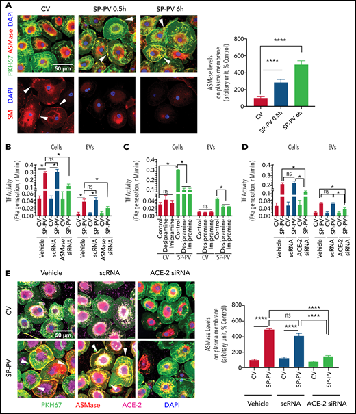 SARS-CoV-2–SP-PV–induced increased TF activity is dependent on ASMase and ACE2. (A) SARS-CoV-2–SP-PV infection induces the translocation of ASMase to the cell surface and reduces SM content in the plasma membrane. MDMs were infected with a control vehicle (CV) or infected with SARS-CoV-2–SP-PV (SP-PV) for 0.5 or 6 hours. Top of image: plasma membrane was stained with PKH67 fluorescent dye (green). For immunostaining ASMase, fixed and permeabilized cells were incubated with rabbit anti-human ASMase antibody (2 µg/mL) at 4°C overnight. After removing the primary antibodies and washing the cells, the cells were incubated with AF546-conjugated donkey anti-rabbit IgG (2 µg/mL) for 90 minutes (red). Nuclei were stained with 4′,6-diamidino-2-phenylindole (DAPI; blue). The yellow color in the plasma membrane (white arrow marks) represents the colocalization of ASMase staining with PKH67 fluorescence in the plasma membrane, indicating the translocation of ASMase to the outer leaflet of the plasma membrane. The fluorescence signaling intensity of ASMase in the plasma membrane was quantified by choosing 30 random areas in the plasma membrane and using ImageJ software (National Institutes of Health). The quantified data were shown in a bar graph. Bottom of image: to label plasma membrane SM, fixed and nonpermeabilized cells were incubated with an SM-binding protein, lysenin (1 µg/mL), for 2 hours at room temperature, and then cells were incubated with rabbit anti-human lysenin antibody (1:200) overnight, followed by secondary antibody, AF546-conjugated donkey anti-rabbit IgG for 90 minutes (red). Nuclei were stained with DAPI (blue). The immunofluorescence staining of SM (red) was analyzed by confocal microscopy. White arrowheads point out SM in the outer plasma membrane in control (noninfected) cells. (B) ASMase silencing attenuates the SARS-CoV-2–SP-PV–induced increased TF activity. MDMs were transfected with transfection reagent (vehicle), scrambled oligonucleotide (scRNA), or siRNA specific for ASMase (100 nM) using X-tremeGene transfection reagent. After 48 hours, transfected MDMs were infected with the pseudovirus for 6 hours, and EVs released into the supernatant medium were isolated. Cell surface TF activity and TF activity associated with EVs were measured as described in panel C. (C) ASMase functional inhibitors attenuate SARS-CoV-2–SP-PV–induced increased TF activity in MDMs. MDMs were pretreated with an ASMase inhibitor, desipramine (1 μM) or imipramine (1 μM), for 1 hour and then infected with the pseudovirus for 6 hours. EVs released into the supernatant medium were isolated. TF activity on the cell surface and associated with EVs was determined by adding FVIIa (10 nM) and the substrate factor X (175 nM) and measuring the rate of factor Xa generation. (D) ACE-2 silencing attenuates SARS-CoV-2–SP-PV–induced increased TF activity. MDMs were transfected with transfection reagent (vehicle), scrambled oligonucleotide (scRNA), or siRNA specific for ACE-2 (100 nM). After 48 hours, the transfected MDMs were infected with the pseudovirus for 6 hours, and EVs released into the supernatant medium were isolated. TF activity on cell surfaces or EVs was measured as described for panel C. (E) ACE-2 silencing blocks SARS-CoV-2–SP-PV–induced ASMase translocation to the outer leaflet of the plasma membrane. MDMs transfected with transfection reagent (vehicle), scrambled oligonucleotide (scRNA), or siRNA specific for ACE-2 (100 nM) were infected with the pseudovirus for 6 hours. After that, cells were fixed, permeabilized, and stained with rabbit anti-human ASMase antibody as described in panel A (red). Cells were also immunostained for ACE-2 (magenta). Nuclei were stained with DAPI (blue) and plasma membrane was stained with PKH67 fluorescent dye (green). White arrowheads point out ASMase translocated to the plasma membrane in the vehicle-treated or scRNA-transfected cells that were infected with the pseudovirus. The fluorescence signaling intensity of ASMase staining in the plasma membrane was quantified using Image J software. These data were shown in a bar graph. Statistical significance between the 2 groups was calculated using the Mann-Whitney test. *P < .05; ****P < .0001; ns, not statistically significant.
