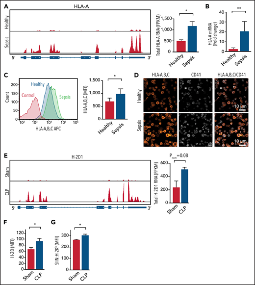 MHC-I expression increases in both human and mouse platelets during sepsis. (A) IGV snapshots on the left show representative reads of 1 MHC-I allele HLA-A by RNA sequencing (RNA-seq) in platelets from a healthy donor and a patient with sepsis. The summarized HLA-A RNA expression in platelets from healthy donors and septic patients is shown at the right (n = 5). (B) Fold increase of HLA-A messenger RNA (mRNA) expression detected by quantitative real-time PCR in platelets from patients with sepsis compared with platelets from healthy donors normalized to human TUBB1 (n = 8-9). (C) Representative flow plots on the left showing increased MHC-I on the surface of platelets from a patient with sepsis compared with platelets from a healthy donor and summarized quantification on the right (n = 20). (D) Representative immunofluorescent images showing increased MHC-I in platelets from a patient with sepsis compared with platelets from a healthy donor. (E) IGV snapshots on the left show representative reads of H-2D1 from control and CLP mice by RNA-seq (n = 3-4). (F) Increased expression of H-2D on platelet plasma membrane as detected by flow cytometry (n = 7-14). (G) Increased antigen cross-presentation in vivo as measured by SIIN:H-2Kb expression on platelets from mice after OVA treatment (n = 3-4). An unpaired Student t test and Mann-Whitney test were used. *P < .05, **P < .01. FPKM, fragments per kilobase; MFI, mean fluorescence intensity.