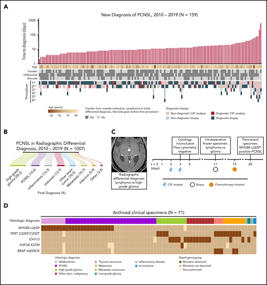 The TetRS qPCR-based rapid genotyping panel detects recurrent molecular alterations relevant to the diverse radiologic differential diagnosis of PCNSL and subsequent diagnostic workup. (A) Clinical characteristics of 159 patients who established a new diagnosis of PCNSL at our facility. Diagnostic assays include all procedures performed at our facility and outside facilities. Time to diagnosis is displayed on a logarithmic scale, calculated from date of admission to our facility. One patient is not displayed, who had 4 lumbar punctures as an outpatient, with the final assay returning positive on the first day of inpatient admission. This cohort included 2 HIV-positive (1.3%), 17 EBV-positive (10.7%), and 13 immunosuppressed patients (8.2%) (supplemental Table 1). (B) Final diagnosis among patients with a new brain lesion with PCNSL in the differential diagnosis. (C) A representative patient with a new brain lesion underwent 2 nondiagnostic lumbar punctures prior to a brain biopsy. Intraoperative histopathology was inconclusive. Chemotherapy was initiated empirically prior to final pathologic diagnosis due to symptomatic decline. Analysis of archived biopsy tissue revealed the MYD88 L265P mutation. (D) Results of TetRS assay on DNA extracts from 71 archived, clinically annotated biopsy specimens by sensitive detection of hotspot mutations in MYD88, TERT promoter, IDH1/2, H3F3A, and BRAF. Expanded results are shown in supplemental Figure 7. EBV, Epstein-Barr virus; Hem., hematologic; HIV, human immunodeficiency virus.