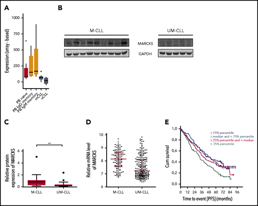MARCKS in CLL and normal B cells. (A) MARCKS transcript expression signal intensity of normal naive, IgG memory, and IgM memory B cells isolated from peripheral blood (PB) and M-CLL and UM-CLL tumor cells from 5 donors each. (B-C) Immunoblot for MARCKS expression in M-CLL and UM-CLL (B) and corresponding densitometric analysis (C) of n = 36 patients. (D) Relative messenger RNA (mRNA) expression of MARCKS in M-CLL and UM-CLL in 337 patients. (E) Correlation of MARCKS expression with PFS of 337 patients with CLL treated with FC or FCR. GAPDH, glyceraldehyde-3-phosphate dehydrogenase.