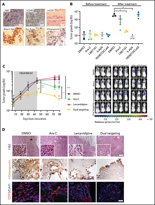 3D-AML drug screening in vivo. (A) Histologic assessment of ex vivo 3D scaffolds 3 weeks after implantation: representative image of hematoxylin and eosin (H&E, ×10 magnification, scale bar = 100 µm), human CD45 (×100 magnification; scale bar, 10 µm), murine CD31 (×20 magnification; scale bar, 50 µm), Alizarin red, von Kossa, and human-osteopontin (×100 magnification, scale bar = 10 µm) staining. (B) 3D scaffolds were seeded with stromal cells (at t = 0) and cultured in vitro for 24 hours before adding the luciferase-transduced SHI-1 AML cell line. After 24 hours, scaffolds were subcutaneously implanted in the back of previously irradiated NSG mice. Luciferase activity was measured before (at day 10) and after (at day 32) treatment. RLI, relative luminescence intensity; total flux = photons/s. Animals were treated daily at the following doses: venetoclax 100 mg/kg (orally), Ara-C 50 mg/kg (intraperitoneally), I-BET151 30 mg/kg (intraperitoneally), 5-azacytidine 5 mg/kg (intraperitoneally); n = 3 mice per group. (C) Tumor growth of luciferase-transduced primary AML cells in 3D scaffold in NSG mice, measured by luminescence activity during treatment with Ara-C 12.5 mg/kg (intraperitoneally) and lercanidipine 3 mg/kg (intraperitoneally), as single agents or in combination (dual targeting). Combination index (CI) = 0.1 at the end of treatment (day 44). CI = 0.5 after treatment withdrawal (day 79). CI <1.0 = synergistic effect. (i) Representative images of bioluminescence in differently treated mice before (at day 7) and after treatment (at day 44) and at treatment withdrawal (at day 79). n = 5 mice per group. (D) Representative images of H&E (×10 magnification; scale bar, 100 µm). Scale bar of images at higher magnitude, 2 µm), human osteopontin immunohistochemical analysis (×10 magnification; scale bar, 100 µm), and CD73 immunofluorescence (×60 magnification; scale bar, 40 µm) staining of scaffolds harvested from mice at the end of treatment. *P < .05, **P < .01, ****P < .0001.