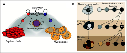 The leukemic state and disease progression. (A) Topology of normal hematopoietic differentiation with the “leukemic state” as a trapped basin in gene expression space. (B) Two models of therapeutic resistance in AML. In the genetic scenario, acquisition of resistance mutations (denoted with R+) in a polyclonal malignancy creates a selective pressure that leads to AML relapse. In the transcriptional state plasticity scenario, cells can occupy a diversity of cellular microstates within the “leukemic state” that make them more or less susceptible to clearance by chemotherapy. If these states are based on the expression of particular TF, then selected states could be inherited in relapse tumors. Importantly, these mechanisms are likely not mutually exclusive and are intrinsically dependent on one another.