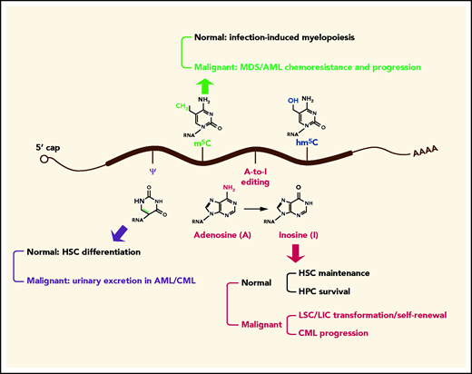 Roles of other RNA modifications in normal and malignant hematopoiesis. In addition to m6A, other RNA modifications, such as A-to-I editing, m5C, and pseudouridine (ψ), are implicated in normal and malignant hematopoiesis. Specifically, ψ synthase is essential for efficient HSC differentiation, and ψ is highly excreted in urine in AML and chronic myeloid leukemia (CML). Increased levels of m5C and its writers confer chemoresistance to MDS/AML cells, m5C writers are positively associated with MDS/AML progression, and m5C eraser TET2 promotes infection-induced myelopoiesis. The writer for A-to-I editing is required for maintenance of HSCs and survival of hematopoietic progenitor cell (HPCs), whereas the same writer promotes transformation of myeloid progenitors into LSCs/LICs and enhances LSC/LIC self-renewal activity. The level of A-to-I editing is positively correlated with CML progression.