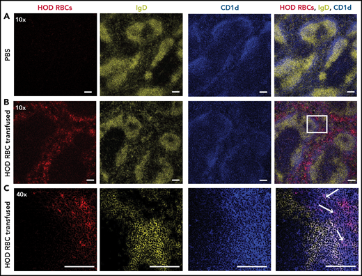 HOD RBCs colocalize with MZ B cells within the marginal sinus of the spleen following transfusion. HOD RBCs were isolated and stained with DiO, resulting in a fluorescently distinct population. (A-B) PBS (A) or DiO-labeled HOD RBCs (red) (B) were injected into HOD− B6 recipients, followed by splenic harvest 24 hours after transfusion and immunofluorescent staining of FO B cells (IgD; yellow) and MZ B cells (CD1d; blue). Samples were analyzed using a Leica SP8 multiphoton confocal microscope with a ×10 (A-B) or ×40 (C) objective. The white box in panel B is magnified in panel C. White arrows indicate examples of colocalization of transfused HOD RBCs with MZ B cells. Scale bars, 100 μm. Representative data are shown from experiments reproduced 2 or 3 times, with 3 mice per group per experiment.