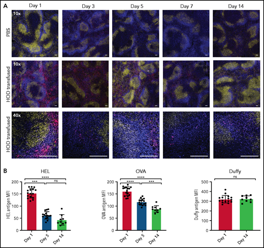 HOD RBCs remain detectable in the marginal sinus despite losing surface antigen over time. HOD RBCs were isolated and stained with DiO, resulting in a fluorescently distinct population. (A) PBS or DiO-labeled HOD RBCs (red) were injected into HOD− B6 recipients, followed by splenic harvest at the indicated time points after transfusion and immunofluorescent staining of FO B cells (IgD; yellow) and MZ B cells (CD1d; blue). Samples were analyzed using a Leica SP8 multiphoton confocal microscope with a ×10 or ×40 objective . Scale bars, 100 μm. (B) Quantitation of HEL, OVA, and Duffy antigen levels detected by flow cytometry at the time points indicated posttransfusion. ****P < .0001, ***P < .0003 1-way ANOVA with Tukey’s post hoc test. ns, not significant.