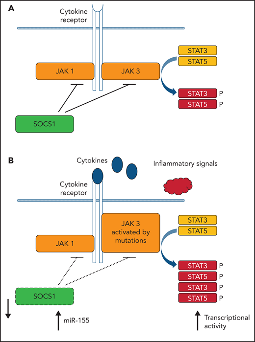 Central role of (aberrant) JAK/STAT signaling in MF. (A) Simplified scheme of JAK/STAT signaling. (B) Alterations found leading to increased transcriptional activity of gene promoters with STAT binding sites. Some features are shared with Sz (eg, malignant inflammation and JAK mutations), whereas others are typical for MF (loss of SOCS1 and upregulation of miR-155).