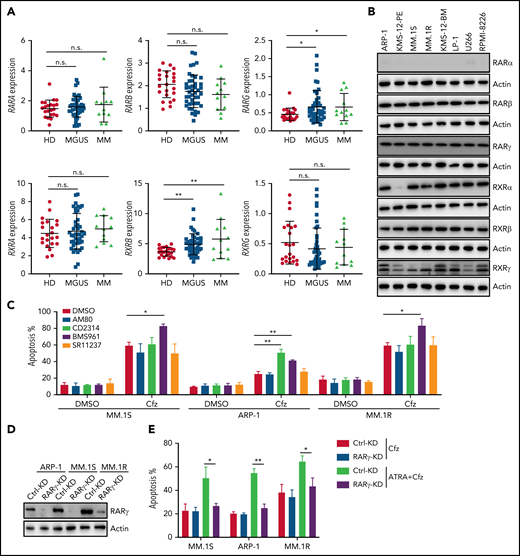 RARγ plays an important role in ATRA sensitizing MM cells to Cfz treatment. (A) Gene-profiling data from Zhan et al’s patient database were analyzed. Dot plot showing ATRA receptors (RARs and RXRs) expression (median-centered intensity) in plasma cells from healthy donors (n = 22), Monoclonal gammopathy of undetermined significance (MGUS; n = 44) and MM (n = 12). (B) Western blot showing expression of ATRA receptors (RARs and RXRs) in human MM cell lines. (C) Summarized results of flow cytometry data showing the apoptosis of MM.1S, ARP-1, or MM.1R MM cells with indicated treatment (10 µM RARα agonist AM80, RARβ agonist CD2314, RARγ agonist BMS961, or pan-RXR agonist SR11237) for 24 hours. (D) Western blot showing RARγ expression in Ctrl-KD or RARγ-KD MM cell lines. (E) Summarized results showing apoptosis of Ctrl-KD or RARγ-KD MM cells pulsed with 1-hour Cfz treatment followed by ATRA treatment for 24 hours. Student t test was used to compare 2 samples. n.s., no significance. *P < .05; **P < .01.