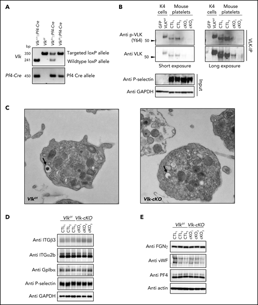 Vlk deficiency in platelets does not affect platelet morphology or levels of platelet receptors and cargo proteins. (A) Analysis of genomic DNA from Vlk+/+::Pf4-Cre, Vlkf/f, Vlkf/+::Pf4-Cre, and Vlkf/f::Pf4-Cre mice. Targeted loxP allele (fl) is 350 bp; wildtype allele (+) is 241 bp; and Pf4-Cre allele is 450 bp. (B) Western blot analysis of phosphorylated and total VLK immunoprecipitates (VLK-IP) prepared from Vlkf/f (CTL) and Vlk-cKO (cKO) washed platelet lysates. Lysates from K4 synoviocytes stably expressing green fluorescent protein (GFP) or wild-type mouse VLK (VLKWT) were used as controls for VLK protein. Eluates were treated with PNGase-F. Anti–P-selectin and GAPDH were used as controls for platelet-specific and total protein levels in input samples, respectively. (C) Representative image of electron microscopy analysis of resting Vlkf/f and Vlk-cKO platelets. Dense granules are indicated by black arrows. Representative images were obtained at 13 000×. Protein levels in platelets from Vlkf/f (CTL) and Vlk-cKO (cKO) mice (n = 3 mice per genotype). Anti-GAPDH and actin antibodies were used to examine total protein levels of platelet receptors integrin (ITG) β3, integrin α2b, glycoprotein Ibα (GpIbα), and P-selectin (D) as well as platelet cargo fibrinogen (FGN), von Willebrand factor (vWF), and PF4 (E).