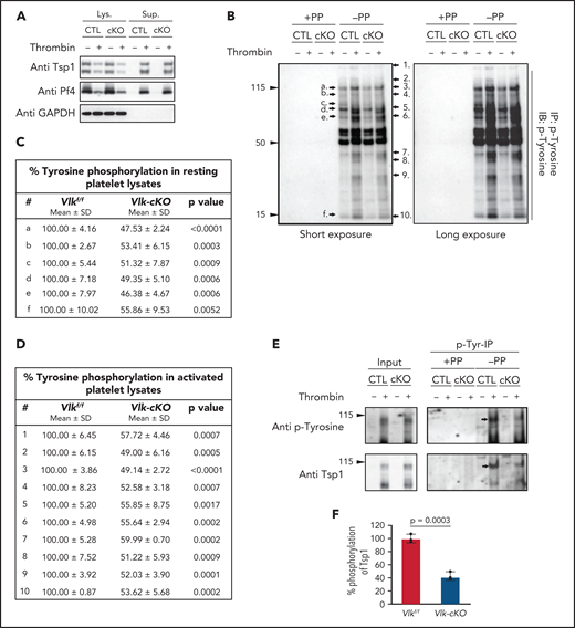 Reduced tyrosine phosphorylation in resting and activated mouse platelets harboring deletion of Vlk compared with control. (A) Immunoblots of lysates (Lys.) and supernatants (Sup.) from Vlkf/f (CTL) and Vlk-cKO (cKO) platelets resting or stimulated with 5 U/mL thrombin for 15 minutes. Anti-Tsp1 and anti-PF4 antibodies were used as markers of platelet activation, and anti-GAPDH antibody was used to examine total protein levels in lysates. (B) Lysates from panel A were used to examine tyrosine phosphoproteins by immunoblot (IB) of p-Tyr–enriched fraction (IP). Black arrows indicate phosphobands decreased in Vlk-cKO (cKO) compared with Vlkf/f (CTL) in resting (a-f) and activated (1-10) platelets. Cumulative percent tyrosine phosphorylation in phosphorylated proteins indicated in representative figure in panel B from resting (C) and activated (D) control and Vlk-cKO lysates. Data are expressed as mean ± standard deviation (SD); n = 3 independent experiments. Quantifications were normalized to GAPDH protein expression. (E) Representative image of input and p-Tyr IP fraction from resting and thrombin-stimulated supernatants analyzed by using SDS-polyacrylamide gel electrophoresis (PAGE) with 8% gels and immunoblotting with anti–p-Tyr and anti-Tsp1 antibodies. Phenyl phosphate (PP) was used as negative control for nonspecific binding to p-Tyr beads. Black arrows indicate bands decreasing in cKO compared with CTL. (F) Cumulative percent phosphorylation of Tsp1 in activated supernatants from Vlk-cKO compared with CTL; n = 3 independent experiments.