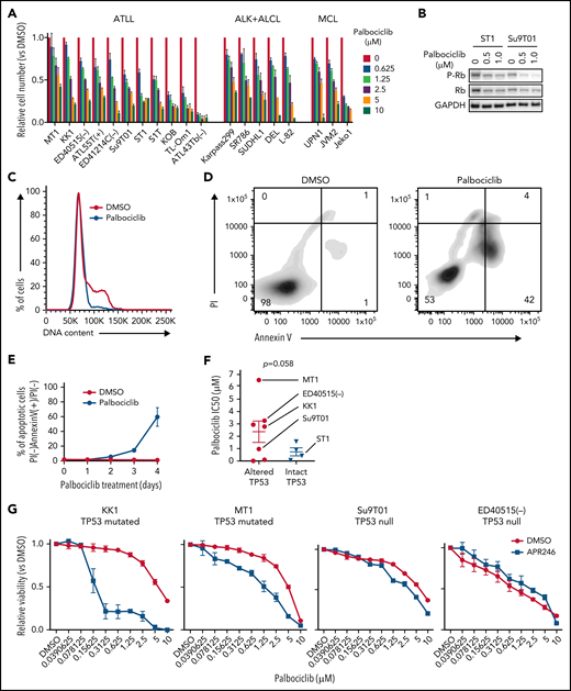 CDK4/6 inhibitor palbociclib inhibits ATLL cell proliferation and survival. (A) Viable cells were measured by the MTS assay for the indicated ATLL, ALK+ALCL, and MCL cell lines treated with palbociclib for 4 days. (B) Immunoblot analysis of phosphorylated Rb protein in ST1 and Su9T01 cells treated with palbociclib for 24 hours is shown. (C) DNA content was analyzed in ST1 ATLL cells treated with 1 μM of palbociclib for 24 hours. (D) Apoptotic cells were detected by analyzing Annexin V and propidium iodide (PI) on flowcytometry on day 4 after palbociclib treatment with 1 μM. (E) The ratio of PI(-)Annexin V(+) cells/PI(-) cells was monitored over time. (F) IC50 values for palbociclib in TP53-altered and TP53-intact ATLL cell lines are shown. (G) Viable cells were measured by the MTS assay for the indicated ATLL cell lines treated with the indicated concentrations of palbociclib and APR-246 for 4 days. (H) Cells were infected with a lentivirus expressing sgTP53 together with GFP, followed by treatment with palbociclib at the indicated concentrations. Shown is the fraction of GFP-positive cells at indicated time points normalized to day 0. (I) Cells were infected with a lentivirus expressing sgTP53 or control sgAAVS1 together with GFP, then treated with 1 μM of palbociclib for 24 hours. DNA content was analyzed in the GFP-positive fraction (blue, the cells have sgRNA) and GFP-negative cell fraction (red, the cells don’t have sgRNA). (J-K) Cells were infected with a lentivirus that expresses sgTP53 or control sgAAVS1 together with puromycin-resistant gene. After puromycin selection of the transduced cells, cells were grown in the culture media without puromycin for several days to recover the cell condition well. Then the cells were treated with 1 μM of palbociclib, and apoptotic cells were detected by analyzing Annexin V and propidium iodide (PI) on flowcytometry over time (J). Representative density plot illustrating the apoptotic cells on day 6 after palbociclib treatment (K). (L) Immunoblot analysis of p21 and p27 proteins in sgCDK6-transduced ST1. (M) Immunoblot analysis of p21 and p27 proteins in palbociclib-treated ATLL cell lines. TP53 status for each line is shown below the cell line name. (N) KK1 cells were infected with a lentivirus that expresses sgCDK2 or control sgAAVS1 together with GFP, followed by treatment with palbociclib (0.25 μM). Shown is the fraction of GFP-positive cells over time relative to the GFP-positive fraction on day 0. (O) ST1 cells were infected with a lentivirus expressing sgTP53 or control sgAAVS1 together with puromycin-resistance gene. After puromycin selection, cells were infected with a lentivirus expressing sgCDK2 or control sgAAVS1 together with GFP, followed by treatment with palbociclib (0.25 μM). Shown is the fraction of GFP-positive cells over time relative to the GFP-positive fraction on day 0. Error bars represent the SEM of replicates (A,E-H,J,N-O). **P < .01.