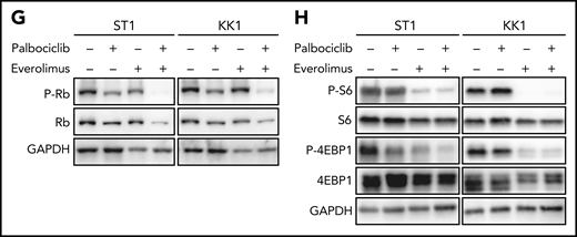 MTOR is a targetable vulnerability in ATLL, and the combination of palbociclib with mTORC1 inhibitors is synergistically toxic for ATLL cells. (A) Heatmap of gene essentialities identified in genome-wide CRISPR library screening. The genes were manually selected among genes in T-cell lymphoma-related molecular pathway. (B) Immunoblot analysis of MTOR proteins in sgMTOR-transduced ST1 cells. (C) The indicated cell lines were infected with a lentivirus expressing sgMTOR or control sgAAVS1 together with GFP. The GFP-positive cell fraction was monitored as in Figure 2A. (D) Immunoblot analysis of phosphorylated S6 and phosphorylated 4EBP1 proteins in sgTP53-transduced ST1 cells treated with palbociclib (1 μM) for 4 hours. (E) Upper panel: viable cells were measured by the MTS assay for the indicated ATLL cell lines treated with the indicated concentrations of palbociclib and everolimus for 4 days. Lower panel: a combination index is shown. Lower than 1.0 indicates a synergistic effect. (F) Upper panel: viable cells were measured by the MTS assay for sgTP53- or control sgAAVS1-transduced ST1 cells treated with the indicated concentrations of palbociclib and everolimus for 4 days. Lower panel: a combination index is shown. Lower than 1.0 indicates a synergistic effect. (G,H) Immunoblot analysis of phosphorylated Rb (G), phosphorylated S6 (H), and phosphorylated 4EBP1 proteins (H) in ST1 and KK1 cells treated with palbociclib (0.5 μM and 1.25 μM, respectively) and everolimus (2.5 μM) for 24 hours. Error bars represent the SEM of replicates (C,E-F).