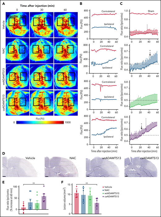 Restoration of rCBF to the ipsilateral MCA territory following administration of caADAMTS13 at 1 hour post-FeCl3–induced thrombotic MCAo in mice. (A) Representative laser speckle contrast imaging (LCSI) raw data with defined ipsilateral and contralateral ROIs. (B) Flux values from each ROI were extracted at 1-minute intervals for 5 minutes before and 60 minutes after injection. Shown are representative measurements of ipsilateral and contralateral flux from a single animal in each treatment group. (C) Ratios of ipsilateral and contralateral flux values (plus or minus standard deviation, n = 7) are shown for 5 minutes prior to injection, confirming stable occlusion of the MCA as indicated by flux ratios <0.5 (dotted lines). The times after injection at which the flux ratio breached the 0.5 threshold (indicating recanalisation) are designated by an asterisk. For comparison, the flux ratio from a single animal undergoing sham surgery is also shown (top panel). (D) Representative cresyl violet–stained coronal sections from a single animal in each treatment group used in the determination of cortical lesion volumes. Scale bars, 500 μm. (E) Percentage increase in flux ratio between 0 and 60 minutes postinjection determined for each individual animal; error bars represent mean ± standard deviation. (F) Lesion volumes were determined at 24 hours postocclusion by measuring the area of cell death over 3 to 9 coronal levels; error bars represent mean ± standard deviation. Single comparisons were performed using an unpaired Student t test. **P < .01.