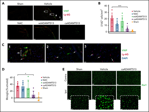 Mice treated with caADAMTS13 1 hour after distal thrombotic MCAo exhibit reduced neutrophil recruitment to the brain parenchyma and reduced peri-infarct microglial activation at 24 hours postocclusion. (A) Recruitment of neutrophils to the ischemic tissue was visualized by IF staining for the neutrophil marker Ly-6G. Images are a representative field of view, chosen to visualize the main site of thrombosis (#), isolated from whole-brain imaging performed using Slidescanner. Scale bars, 200 μm. (B) The number of Ly-6G+ particles, with an area greater than 80 μm2, was measured using automated particle counting applied to thresholded images in ImageJ. (C) Higher magnification images of regions 1 to 3 (indicated in panel A) of a brain section from a vehicle-treated animal. Neutrophils recruited to a VWF-lined vessel (∞) and 4′,6-diamidino-2-phenylindole/Ly-6G–stained cells (presumed to be neutrophils) in the brain parenchyma (white arrows) were observed. Scale bars, 20 μm. (D) The total number of Iba1+ cells and the number of Iba1+ cells with a circularity >0.5 were counted by automated particle analysis of thresholded single-channel images and used to quantify the percentage of total microglia with an activated morphology. (E) Representative Iba1 images from the peri-infarct cortical region of the ipsilateral hemisphere and a corresponding region of the contralateral hemisphere for comparison. Scale bars, 100 μm. Inset images are the ipsilateral field of view at higher magnification to show microglial morphology used to determine activation status. Scale bars, 50 μm. Error bars represent mean ± standard deviation. Single comparisons were performed using an unpaired Student t test. *P < .05, ***P < .001.