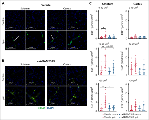 caADAMTS13-mediated dissolution of preformed platelet aggregates in the mouse brain following tMCAo and I/R injury. (A-B) Visualization of platelet aggregates (white arrows) in vehicle and caADAMTS13-treated animals, respectively, was achieved by IF staining for the constitutive platelet marker CD41. Images are representative fields of view from either the striatum or cortex of the ipsilateral hemisphere and equivalent regions of the contralateral hemisphere. Each field of view is shown at 2 magnifications. Scale bars, 100 or 50 μm. (C) Thresholded single channel images were used for automatic particle counting in ImageJ, selecting aggregates based on particle size (0-10, 10-30, and >30 μm2). Error bars represent mean plus or minus standard deviation. Single comparisons were performed using an unpaired Student t test. *P < .05, **P < .01.