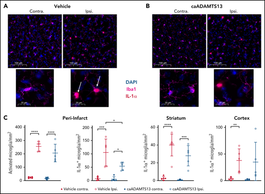 Delayed caADAMTS13 administration after tMCAo and I/R injury in mice reduces IL-1α expression by peri-infarct microglia. (A-B) Microglia in the brains of vehicle- and caADAMTS13-treated animals, respectively, were stained by IF for both Iba1 and IL-1α. Images are representative fields of view from the peri-infarct region of the ipsilateral hemisphere and an equivalent region of the contralateral hemisphere. Each field of view is shown at 2 magnifications. Scale bars, 100 or 20 μm. (C) These images, and images taken from the striatum and cortex of both hemispheres, were analyzed by automated particle counting to identify activated microglia, based on morphology in Iba1 staining, or IL-1α–expressing microglia. Error bars represent mean ± standard deviation. Single comparisons were performed using an unpaired Student t test. *P < .05, **P < .01, ***P < .001, ****P < .0001.