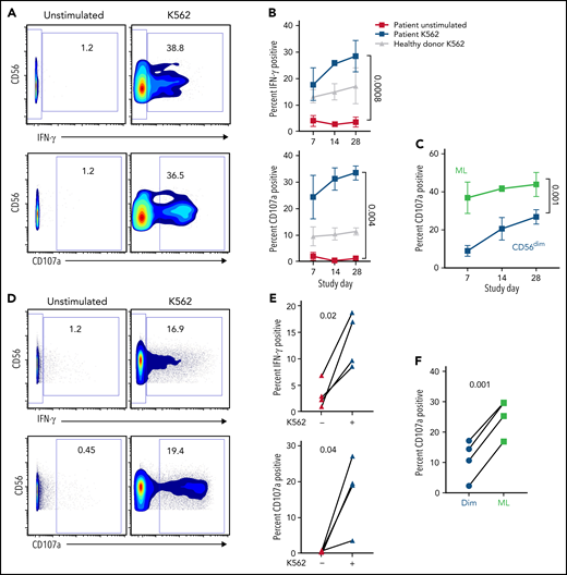 ML NK cells are highly functional ex vivo. NK cells from patient peripheral blood (A-B) and bone marrow (C-D) were unstimulated or stimulated with K562 in a standard 6-hour functional assay. (A) Representative data depicting IFN-γ and CD107a in unstimulated and K562-stimulated NK cells from P-ML007 peripheral blood at day 28. Numbers represent percentage of cells in the indicated gate. (B) Summary data from patient peripheral blood NK cells stimulated as in panel A indicated over time. Healthy donor NK cells (collected at screening) stimulated with K562 are included as representative of naive NK cell response. (C) Summary data for CD107a degranulation gated on CD56dim (CD56dim NKG2A+/−) or ML (CD56hi NKG2A+) NK cells in the same patient’s peripheral blood sample stimulated as in panel A. (B-C) Data are expressed as the mean ± standard error of the mean. (D) Representative data depicting IFN-γ and CD107a in unstimulated and K562-stimulated NK cells from bone marrow of P-ML007 at day 14. Numbers represent the percentage of cells in the indicated gate. (E) Summary data from bone marrow NK cells of each patient shown at day 14 stimulated as in panel D. (F) Summary data for CD107a degranulation gated on CD56dim (CD56dim NKG2A+/−) or ML (CD56hi NKG2A+) NK cells in same patient bone marrow sample stimulated as in (D). (B-C,E-F) Data were available for P-ML002, P-ML003, P-ML005, and P-ML007. Unstimulated and stimulated conditions were tested for normal distribution (Shapiro-Wilk) then compared by using 2-way analysis of variance (B-C) or paired t test (E-F). P-values are indicated above the graphs.