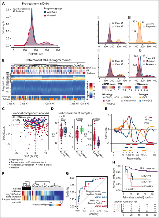 Fragmentation landscapes of cell-free DNA reveal lymphoma-related disparities and provide a mutation-independent relapse predictor in end-of-therapy samples. (A) Histograms demonstrating differences in fragment length distribution between mutated (red) and wild-type (WT, blue) fragments in pretreatment plasma samples from all the patients with single nucleotide variants detected and pretreatment cfDNA sample available. (B) Heatmap showing fragment density according to fragment length (y-axis) in all pretreatment cfDNA profiles (x-axis). Examples of different patterns are demonstrated on the right with smoothened histograms. I: Case#1 with prominent mononucleosomal pattern vs Case#2 with the most prominent dinucleosomal pattern. II: Case#3 histogram favoring longer fragment lengths (perinucleosomal) vs Case#4 histogram favoring shorter fragment lengths (subnucleosomal). III: Case#5 with bifurcation of the mononucleosomal fragments that reflect the difference between mutated and WT fragments (histogram below; red, mutated fragments; blue, reference sequence fragments). (C) Scatterplot of the first 2 dimensions of the principal component analysis (PCA) of fragment profiles with all the cfDNA samples in the study. Colors of the dots represent sample groups indicated in the legend below. (D) Box plots demonstrate the differences in the first 3 components of the PCA between cured and relapsing patients in the end-of-therapy plasma samples. (E) Line graph showing correlation of the first 3 components with fragment size histogram. Below: 9 histogram bin size windows selected based on their correlation with fragment size and mutually exclusive pattern with each other. (F) Heatmaps demonstrate the concordance between the 2 independent predictors of recurrence among the relapsing and nonrelapsing patients. Monte Carlo, mutation-MRD-based relapse predictor with -log10 transformed P values; Random forest, classifier predictions for relapse likelihood 0% to 100%. (G) Receiver operating characteristics curves for the phasing-aware mutation-based (‘Monte Carlo’) and fragmentation-based (‘Random forest’) predictors for recurrence. AUC, area under curve. (H) Kaplan-Meier survival estimates for FFS according to the combined mutation-based MRD test and fragmentation-based random forest prediction results in the end-of-therapy plasma samples.