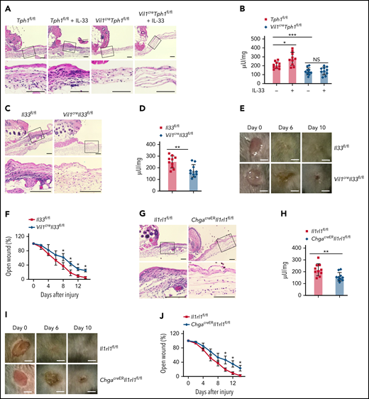 Intestinal IL-33–ST2 signaling regulates axis neutrophil recruitment during acute skin injury via peripheral 5-HT. (A-B) Aseptic skin wounds were punched into the dorsal skin on Tph1fl/fl and Vil1creTph1fl/fl mice with or without IL-33 treatment. (A) Wounded skin samples were collected 4 hours after injury and processed by hematoxylin and eosin (HE) staining. Inset: magnified skin tissue at the injury site. Scale bar, 100 μm. (B) Tissue neutrophil enzyme MPO was assessed from the wound sites. (C-J) Aseptic skin wounds were punched into the dorsal skin on Il33fl/fl and Vil1creIl33fl/fl mice (C-F) or Il1rl1fl/fl and ChgacreERIl1rl1fl/fl mice (G-J). (C,G) Wounded skin samples were collected 4 hours after injury and processed by HE staining. Inset: magnified skin tissue at the injury site. Scale bar, 100 μm. (D,H) Tissue neutrophil enzyme MPO was assessed from the wound sites. (E,I) The Wound sites were photographed at the indicated time. Day-0 picture was taken immediately after the injury. Scale bar, 2.5 mm. (F,J) Graph showing wound closure rate. Data are representative of 2 independent experiments (A, C, E, G, I) or are pooled from 2 independent experiments (B, D, F, H, J). *P < .05, **P < .01 by Student t test. Error bars represent standard deviation. NS, not statistically significant.