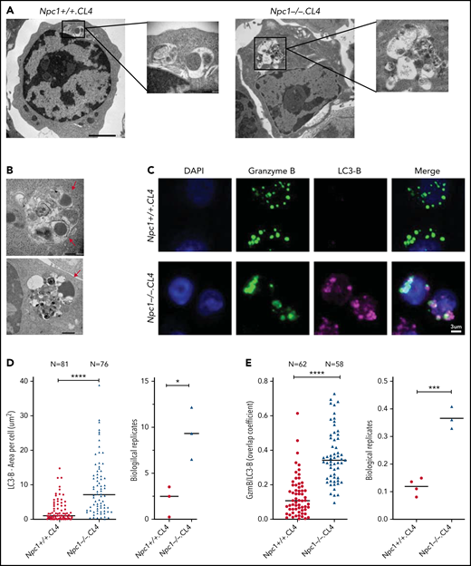 CGs from Npc1−/−.CL4 CTLs are trapped inside enlarged autolysosome-like structures. (A) TEM images of activated Npc1−/− and Npc1+/+ CTLs (scale bar, 2 μm) and zoomed-in autolysosome-like structures (scale bar, 200 nm). (B) TEM images of autolysosome-like structures trapping dense-core granules (arrows) from Npc1−/− CD8+ T cells (scale bar, 500 nm). (C) Confocal immunofluorescence microscopy shows colocalization of GzmB (green) and autophagosomal marker LC3-B (magenta) in activated Npc1−/− and Npc1+/+ CD8+ T cells. Pearson correlation coefficient (bar graph) was used to quantify GzmB and LC3-B colocalization. (D) Total area of LC3-B–labeled structures (as shown in panel C); biological replicates (right). (E) Colocalization of GzmB/LC3-B was assessed using overlap coefficient; biological replicates (right). Detailed description of microscopy and analysis is provided in the data supplement. *P < .05, ***P < .001, ****P < .0001. DAPI, 4′,6-diamidino-2-phenylindole.
