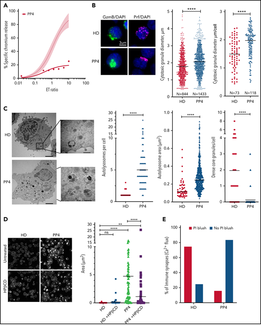 Restoration of cytotoxic activity of CTLs from pediatric patients with NP-C1 by HPβCD. (A) Chromium-51 (51Cr) release assay shows reduced cytotoxicity of CTLs from pediatric patients with NP-C1 at the effector-to-target (E:T) ratios indicated using MDA-MB-231 target cell. Average cytotoxic activity (95% confidence interval shown as shaded gray) of CTLs from 4 HDs. (B) Confocal immunofluorescence microscopy shows GzmB (green)/Prf (magenta) vesicles from an HD and PP4. DAPI is shown in blue. The Diameter of CGs was estimated by computational 3-dimensional re-creation (Imaris vesicles) based on GzmB staining of 2 HD samples and PP4. (C) TEM images show details of activated CTLs (scale bar, 2 μm) and zoomed-in autolysosome-like structures (scale bar, 500 nm). Number of autolysosome-like structures per cell (left), area of autolysosome-like structures per cell (middle), and number of dense-core granules per cell (n = 73 for HD control and n = 72 for PP4). (D) Confocal microscopy of activated CD8+ T cells shows vesicles containing unesterified cholesterol stained with filipin III. HD and PP4 cells were treated with 1 mM of HPβCD for 3 days. Filipin area per cell (right; analysis provided in supplemental Figure 9). (E) Quantification of immunological synapses between anti-HER2 CAR T cells and MDA-MB-231 targets that result in PI blush are shown. Immunological synapses were considered as any events with Ca2+ flux in CTLs (n = 35 HD and n = 19 PP4 synapses). (F) 51Cr release assay of activated HPβCD-treated CTLs killing MDA-MB-231 target cells shows a partial restoration of CTL cytotoxicity from PP4. Detailed description of microscopy and analysis is provided in the data supplement. **P < .01, ****P < .0001. DAPI, 4′,6-diamidino-2-phenylindole; ns, not significant.